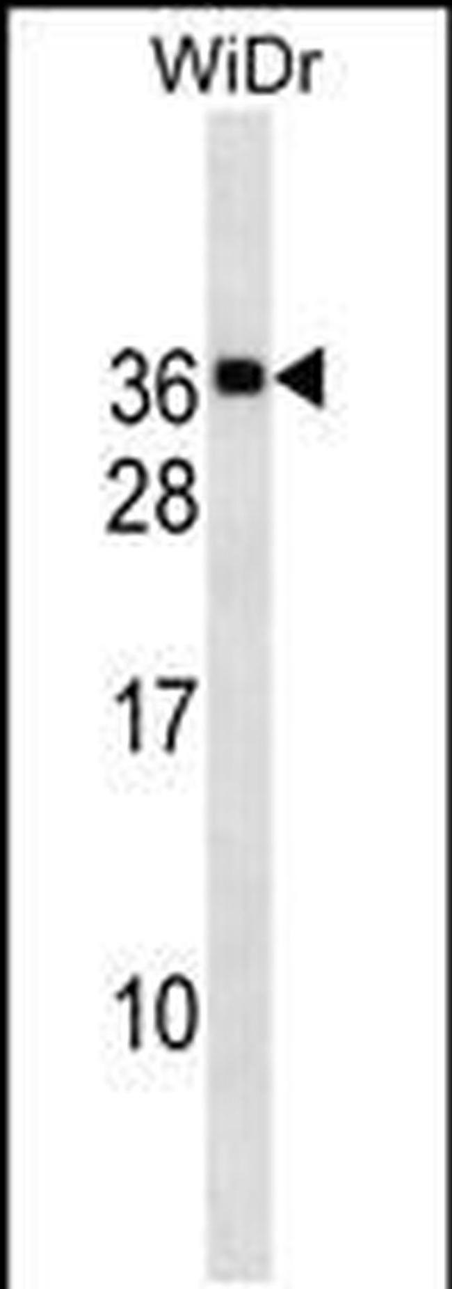 MED30 Antibody in Western Blot (WB)