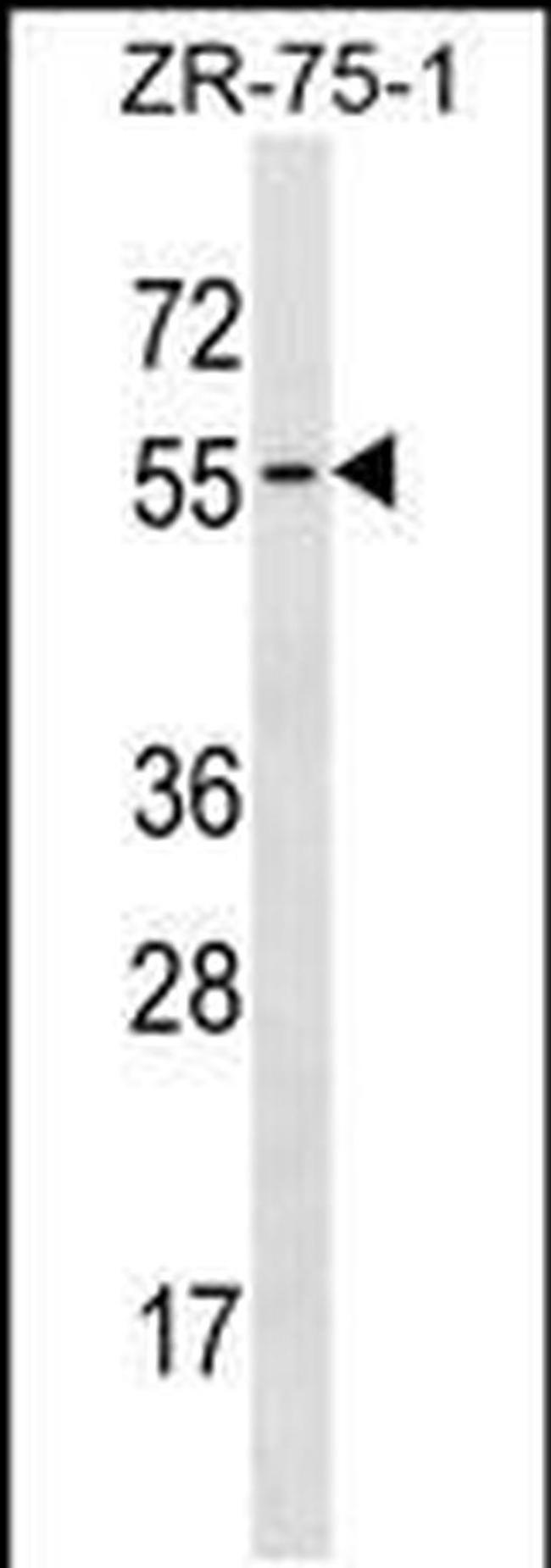 TCN1 Antibody in Western Blot (WB)