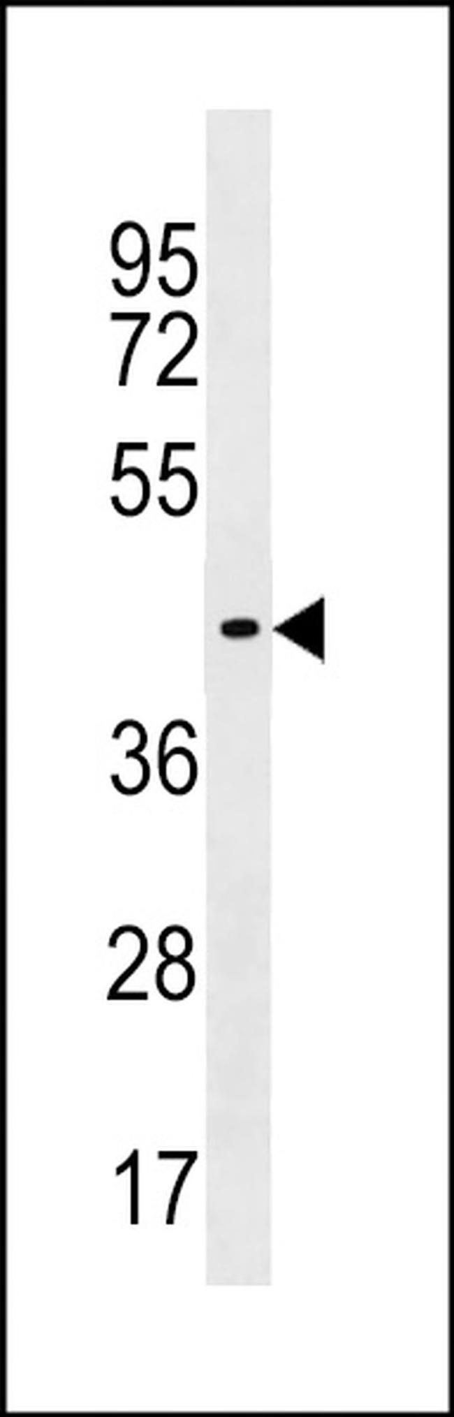 ZNF662 Antibody in Western Blot (WB)