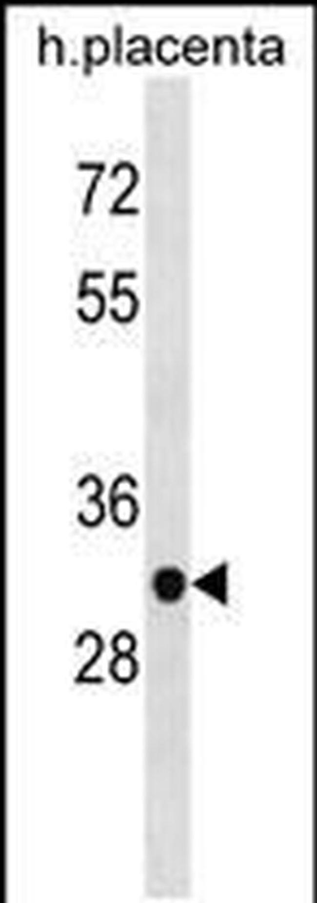ZNF783 Antibody in Western Blot (WB)
