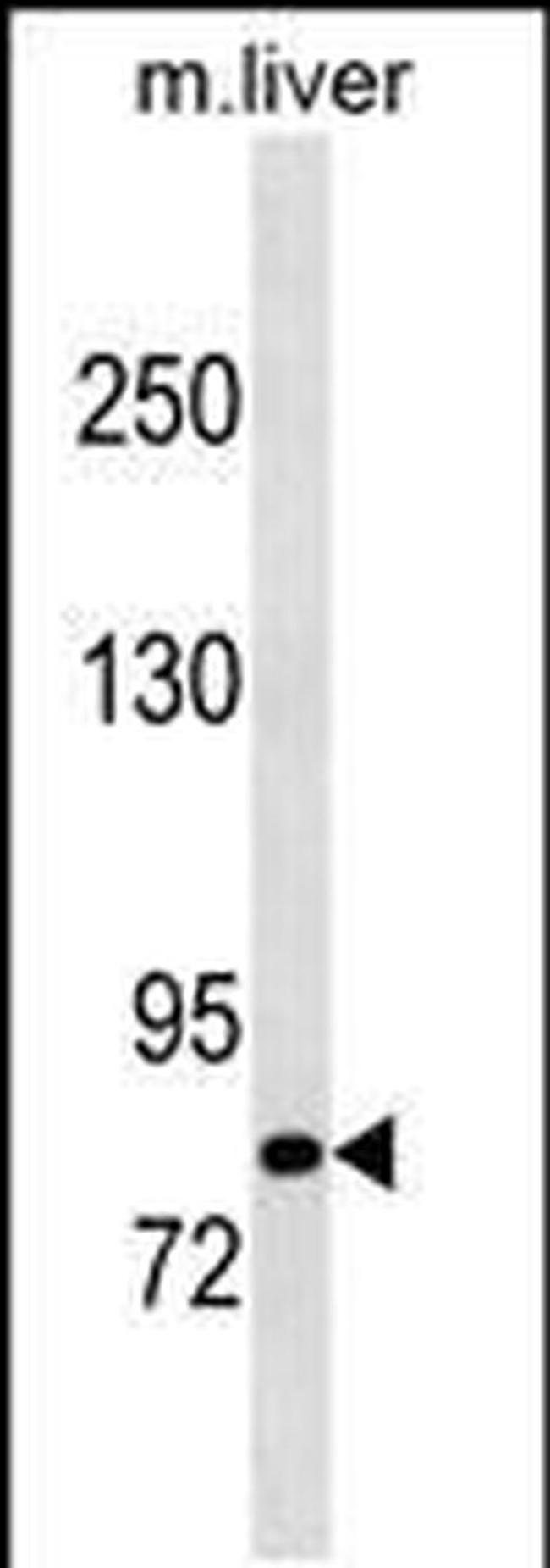 Cbl-b Antibody in Western Blot (WB)