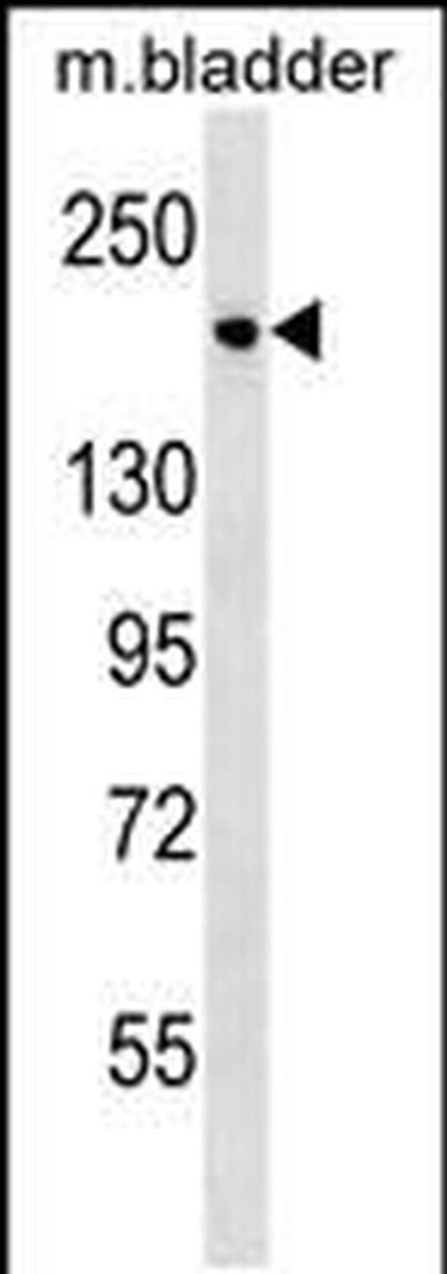 Sash1 Antibody in Western Blot (WB)