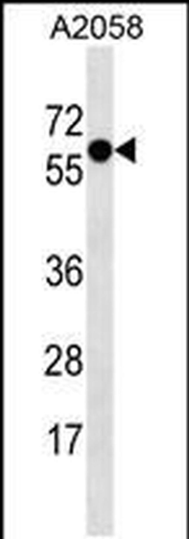 Synaptotagmin 4 Antibody in Western Blot (WB)