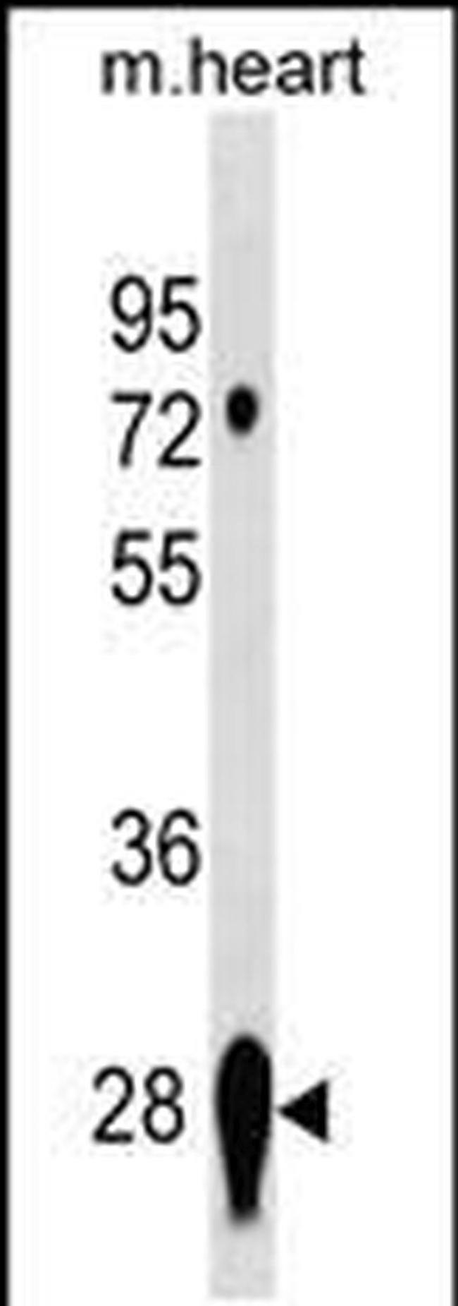 CAPNS2 Antibody in Western Blot (WB)