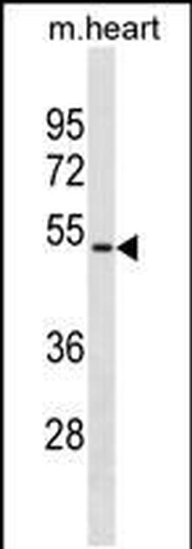 HOXA10 Antibody in Western Blot (WB)