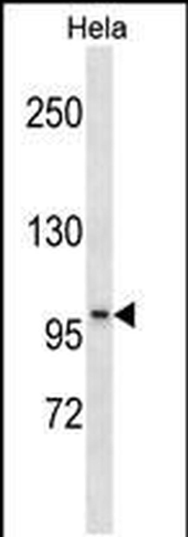 SSH1 Antibody in Western Blot (WB)