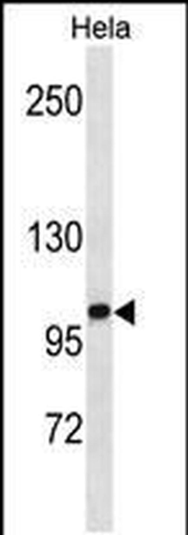 ZHX1 Antibody in Western Blot (WB)