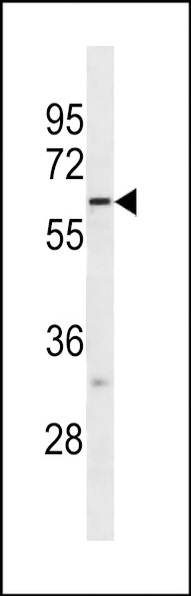 FUT10 Antibody in Western Blot (WB)