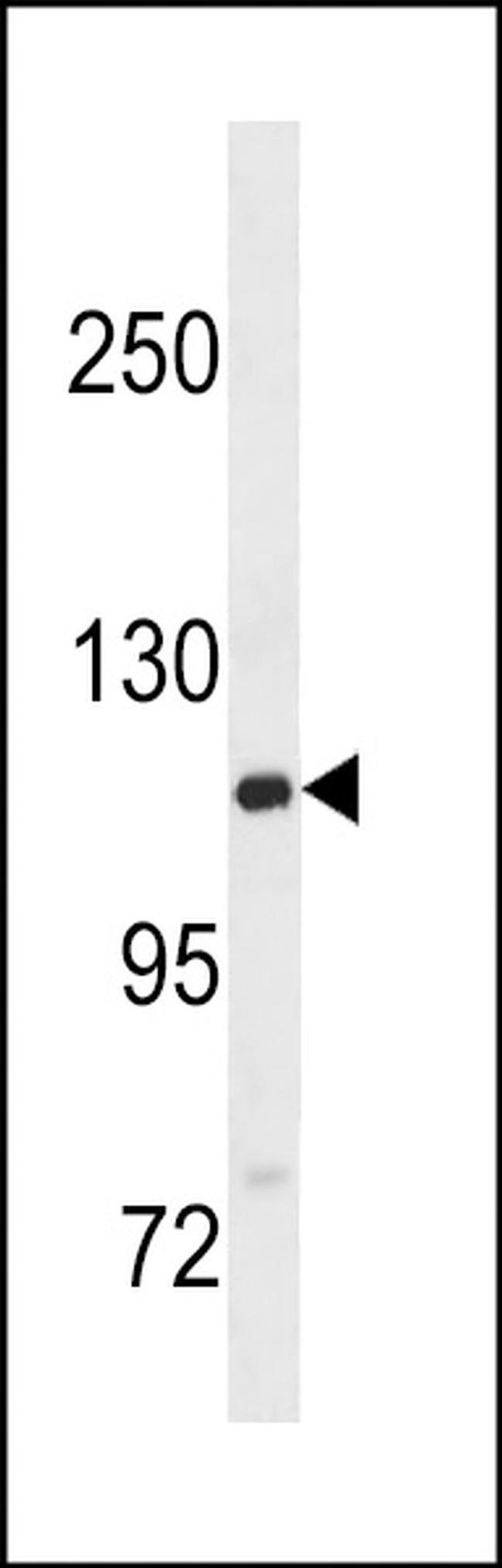 GTF2IRD2B Antibody in Western Blot (WB)