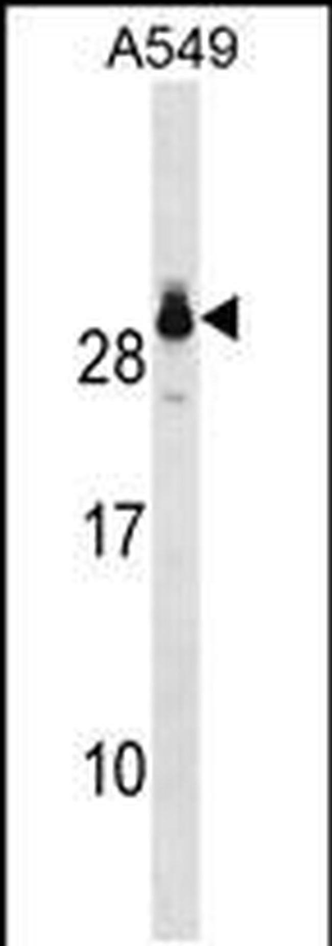 GSTT2 Antibody in Western Blot (WB)