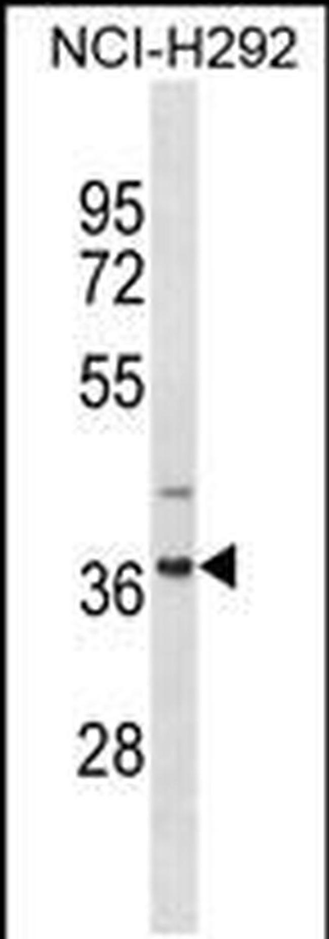 ZNF696 Antibody in Western Blot (WB)