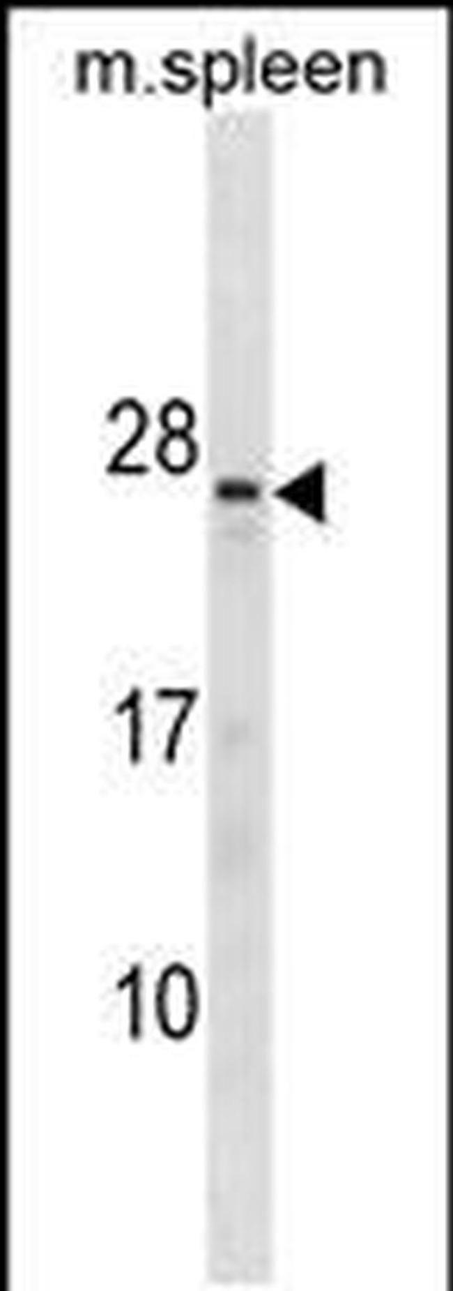 TNNC2 Antibody in Western Blot (WB)