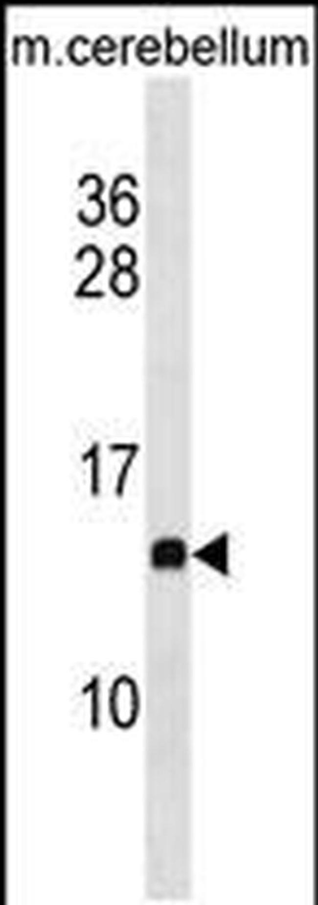 PFDN2 Antibody in Western Blot (WB)