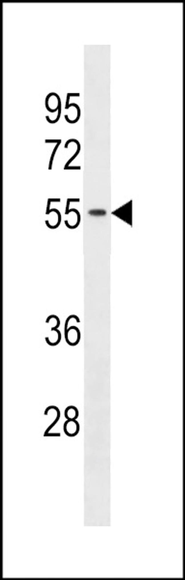 TMX3 Antibody in Western Blot (WB)