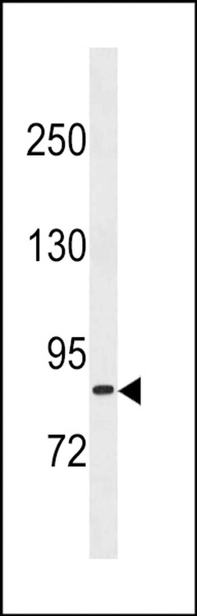 TXNRD3 Antibody in Western Blot (WB)