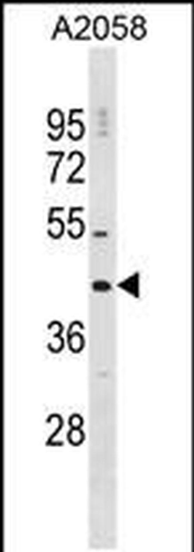 DNAJC25 Antibody in Western Blot (WB)