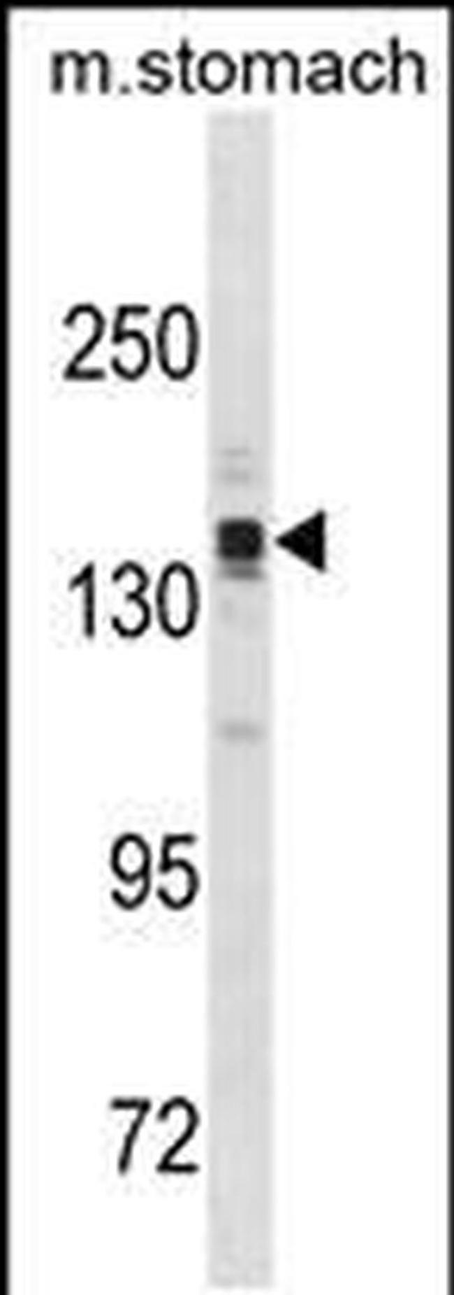 ASTN2 Antibody in Western Blot (WB)