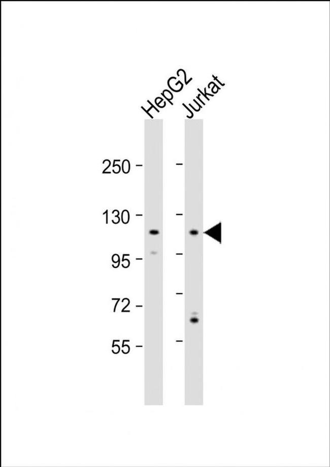 MAN2C1 Antibody in Western Blot (WB)
