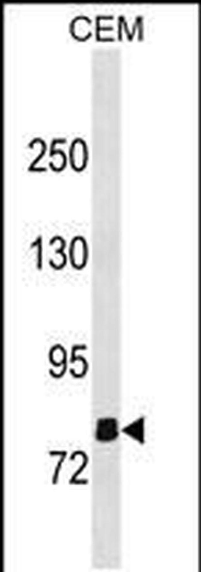 OLFML2B Antibody in Western Blot (WB)