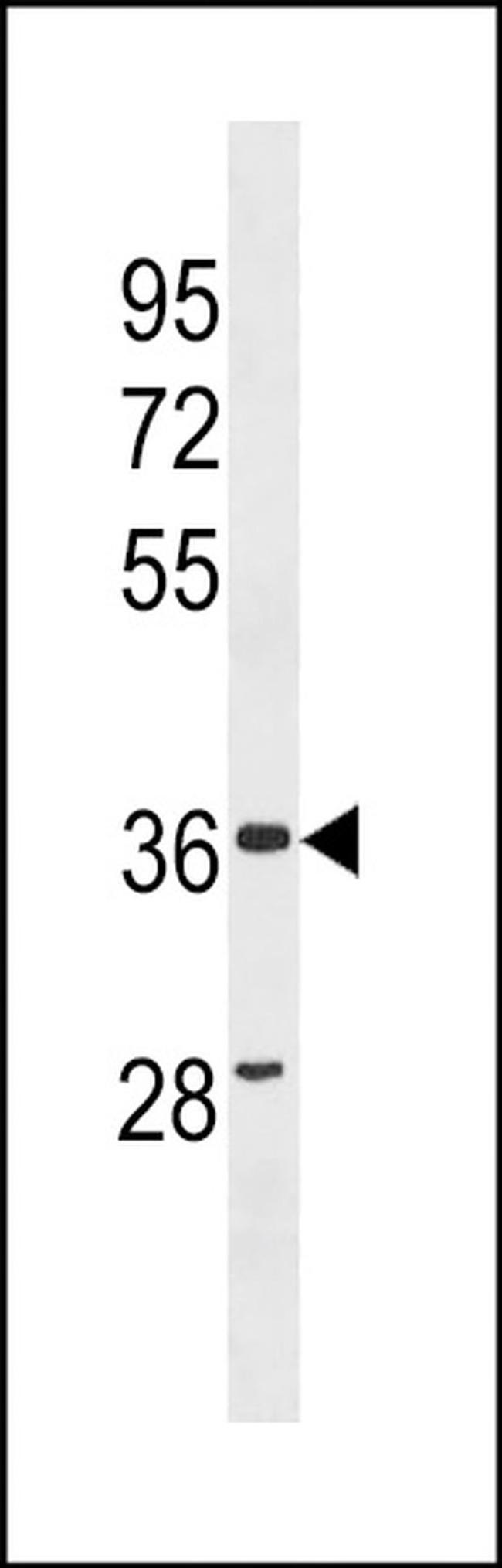 ZC3HAV1L Antibody in Western Blot (WB)
