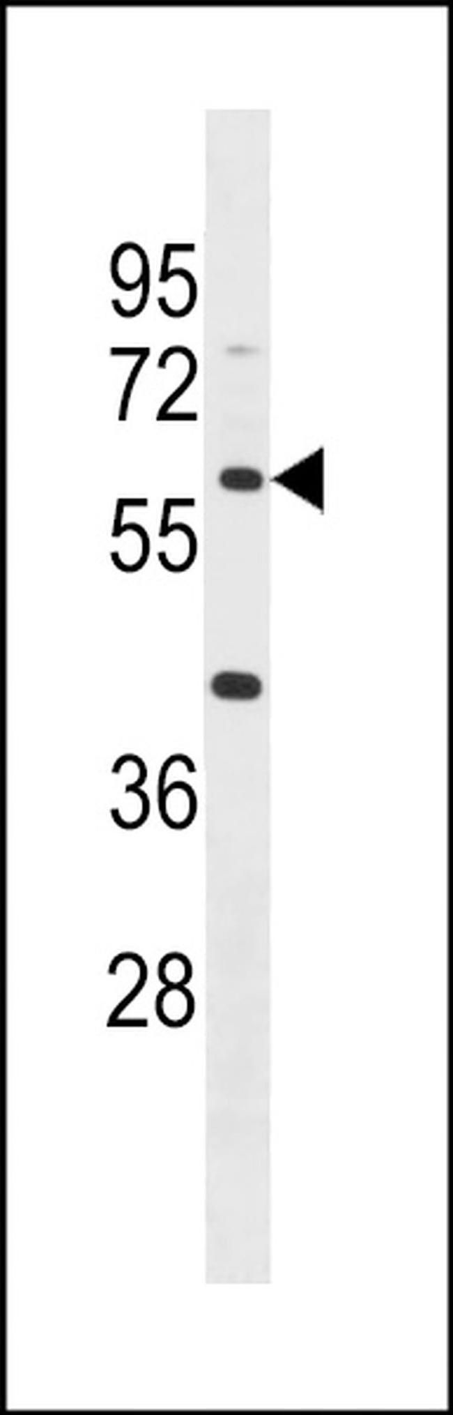 ACSM4 Antibody in Western Blot (WB)