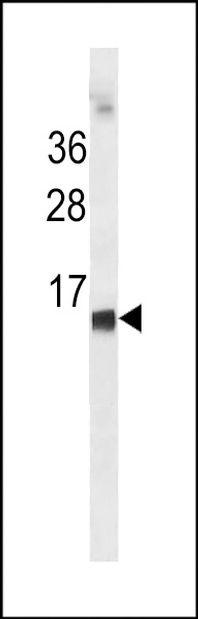 HBE1 Antibody in Western Blot (WB)