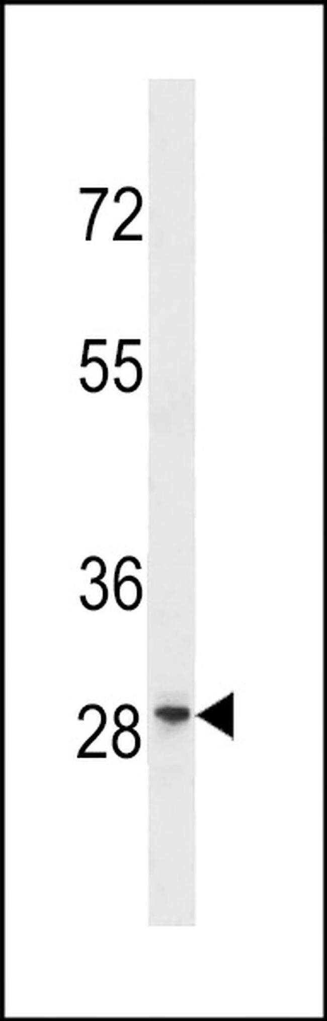GRRP1 Antibody in Western Blot (WB)