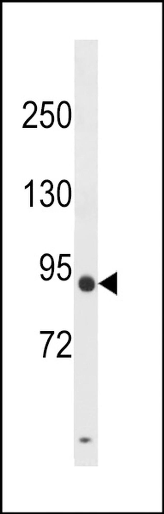 DPY19L3 Antibody in Western Blot (WB)