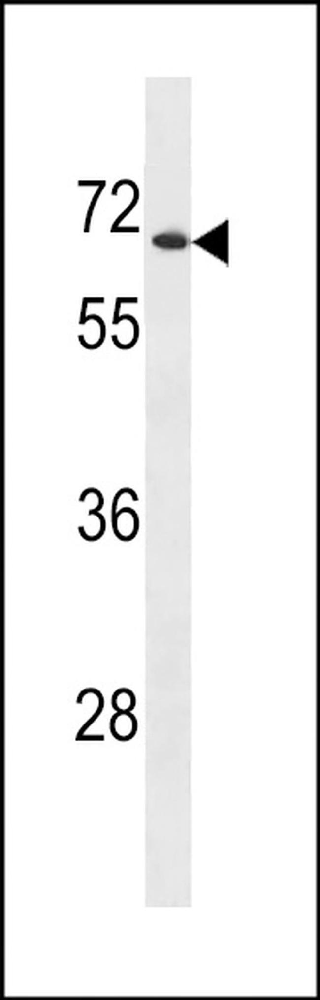 UGT2B28 Antibody in Western Blot (WB)