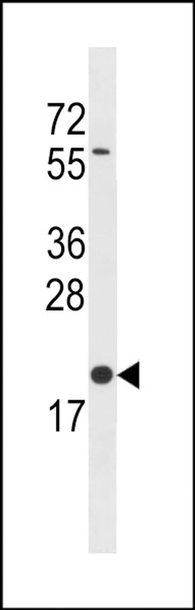 BLOC1S3 Antibody in Western Blot (WB)