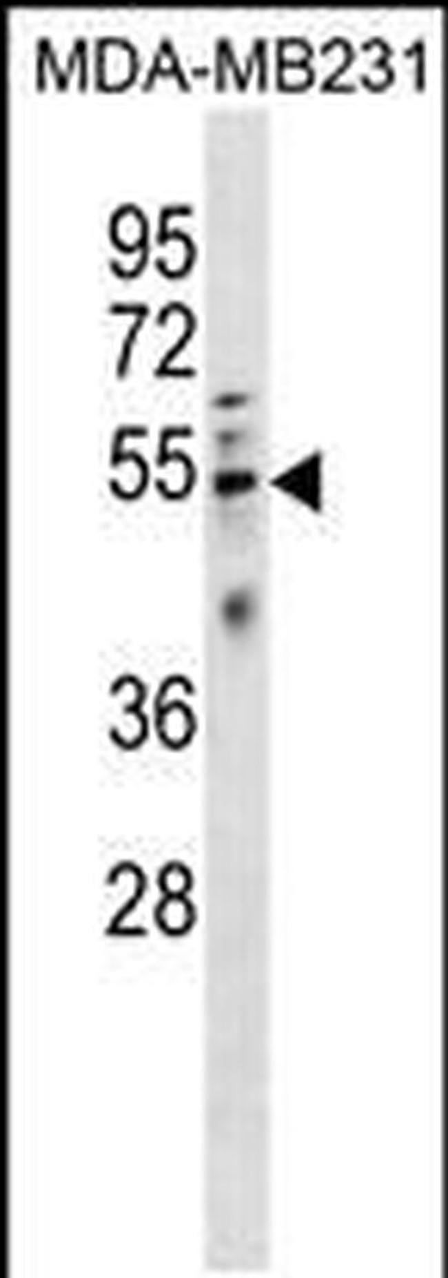 HTRA4 Antibody in Western Blot (WB)