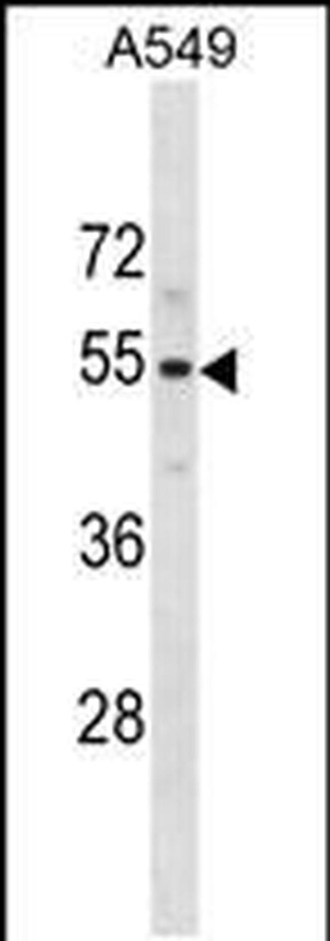 PUS10 Antibody in Western Blot (WB)