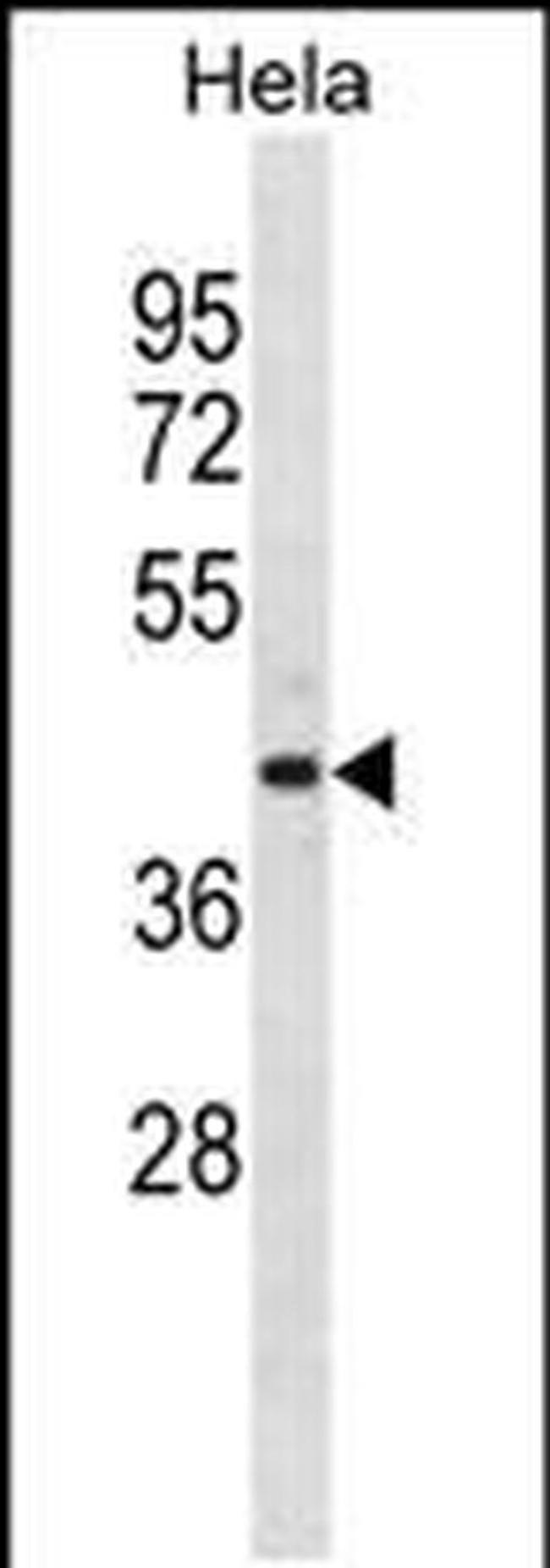 ADPRH Antibody in Western Blot (WB)