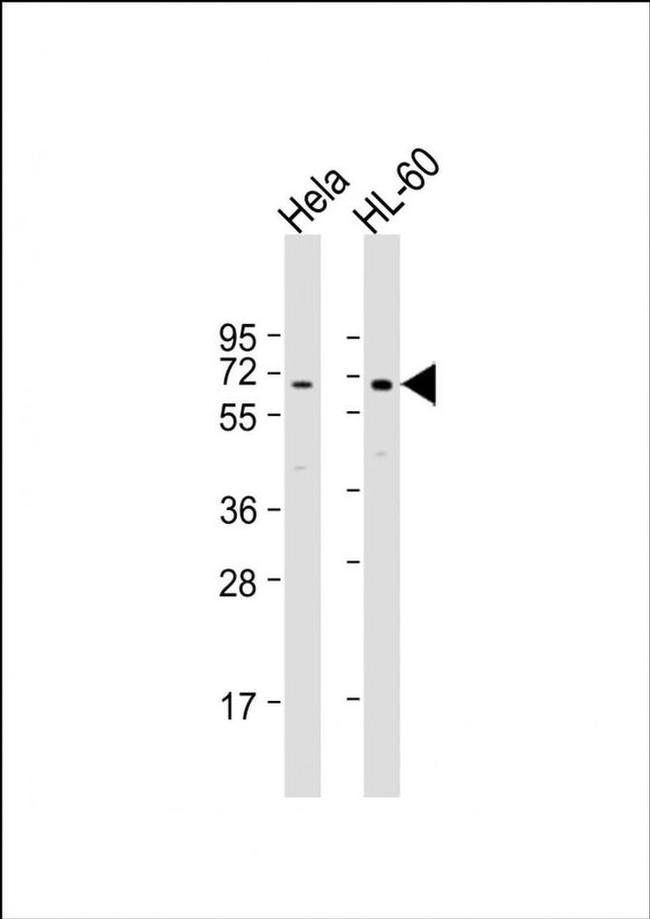 PIGB Antibody in Western Blot (WB)