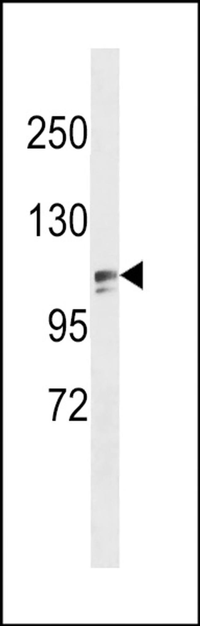ZNF516 Antibody in Western Blot (WB)