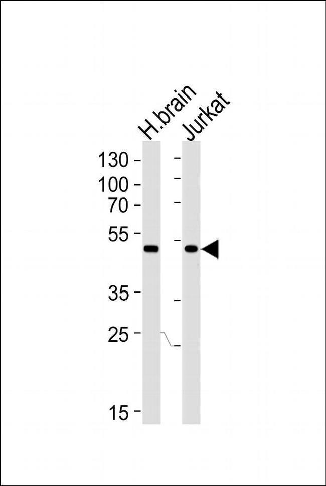 CHN1 Antibody in Western Blot (WB)