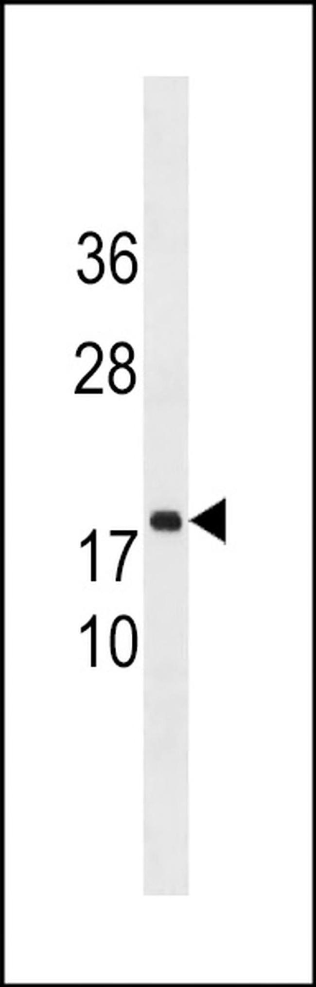 C8orf44 Antibody in Western Blot (WB)