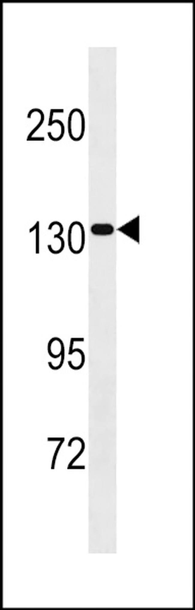 SAPS2 Antibody in Western Blot (WB)