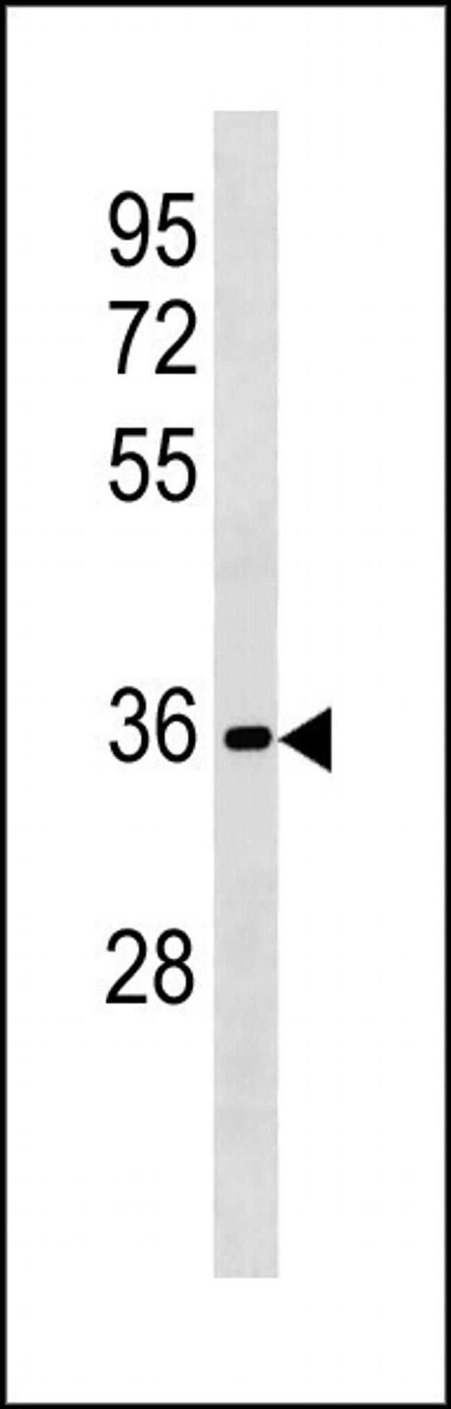 RFPL3 Antibody in Western Blot (WB)