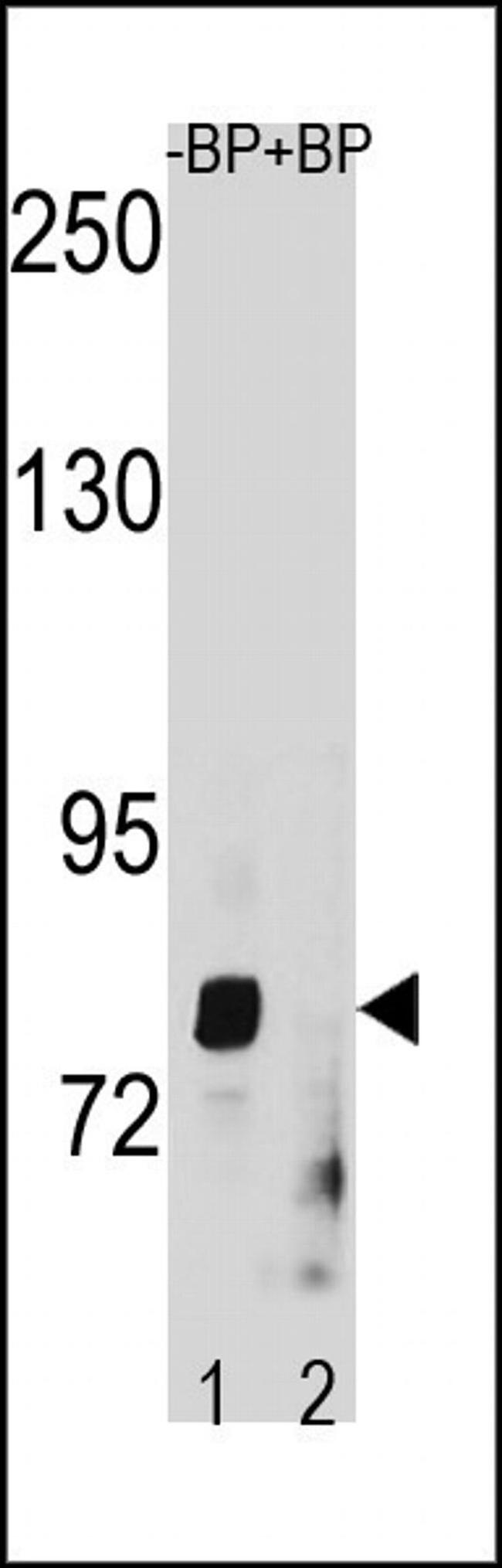 ZMAT1 Antibody in Western Blot (WB)