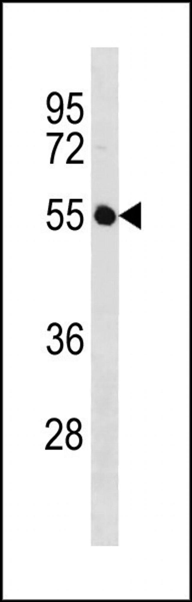 IGSF21 Antibody in Western Blot (WB)
