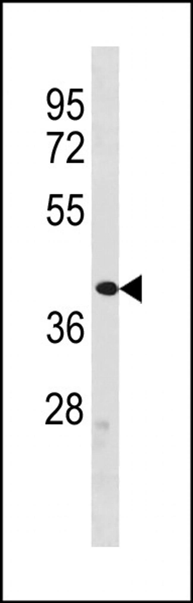 ZFP92 Antibody in Western Blot (WB)