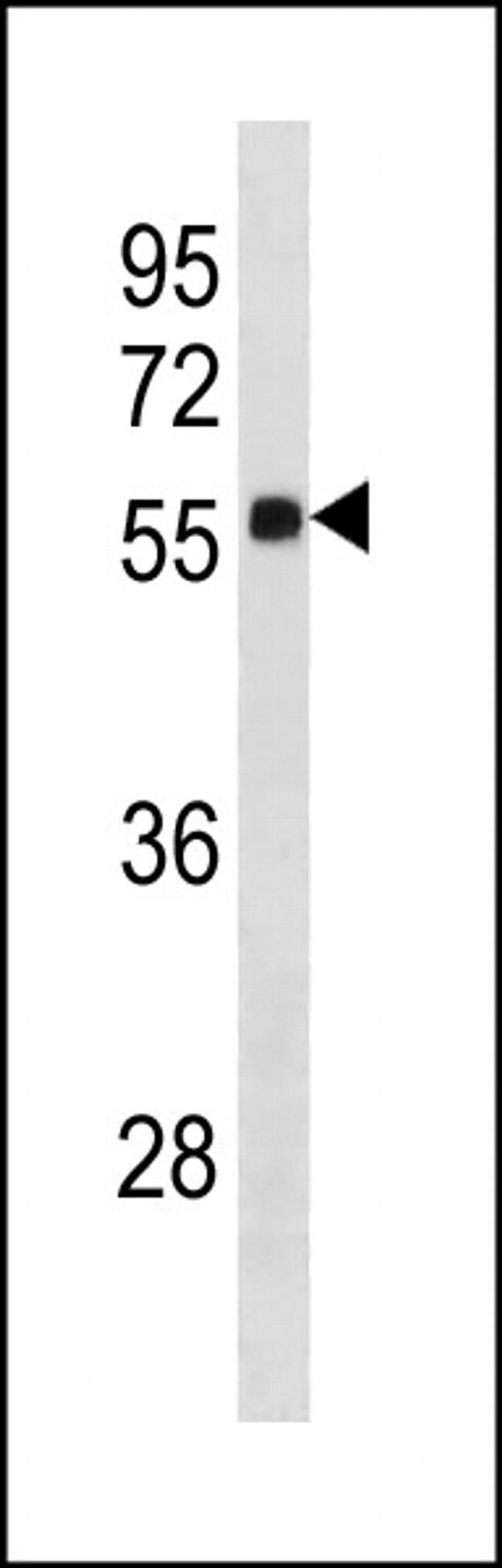 ZNF502 Antibody in Western Blot (WB)