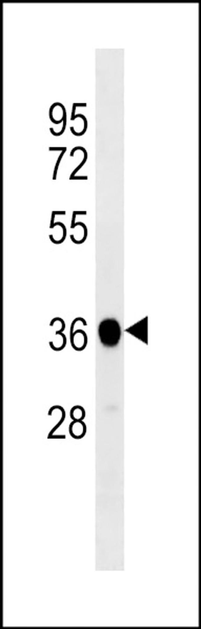 PP1 beta Antibody in Western Blot (WB)