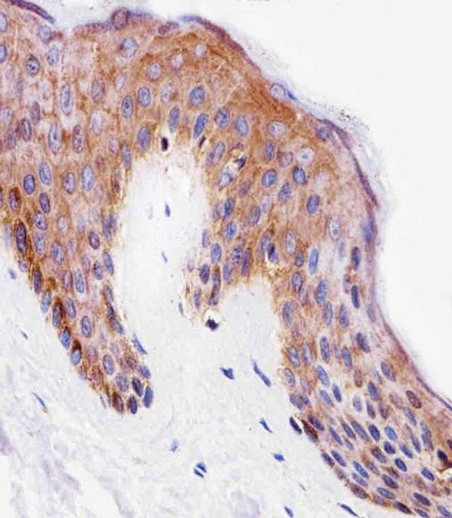 PITPN Antibody in Immunohistochemistry (Paraffin) (IHC (P))