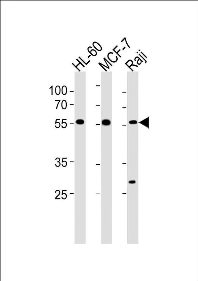 C16orf71 Antibody in Western Blot (WB)