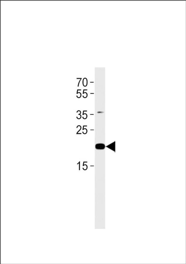 C2orf74 Antibody in Western Blot (WB)