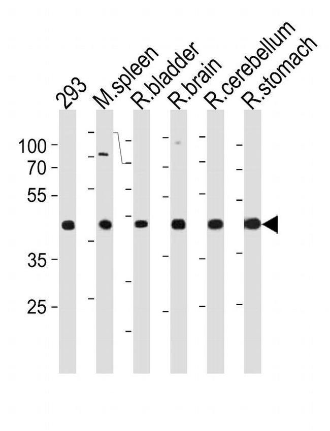 Ccdc89 Antibody in Western Blot (WB)