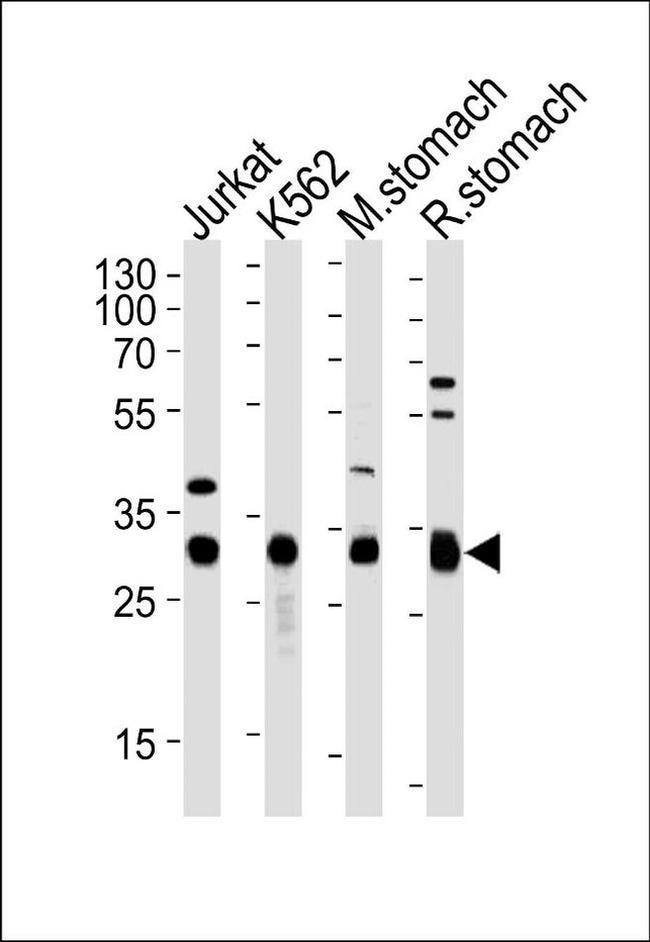 ESD Antibody in Western Blot (WB)