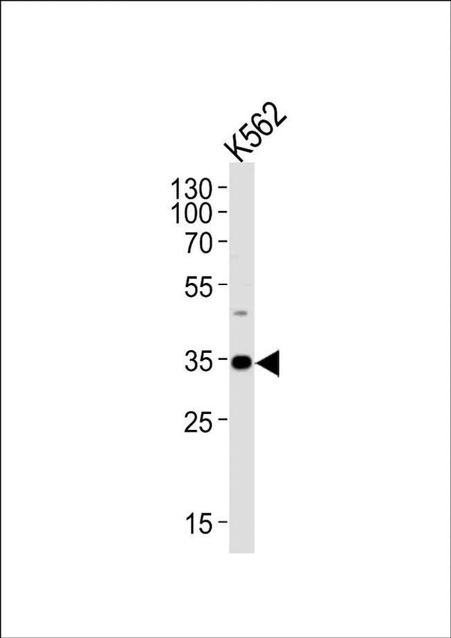 BBS5 Antibody in Western Blot (WB)